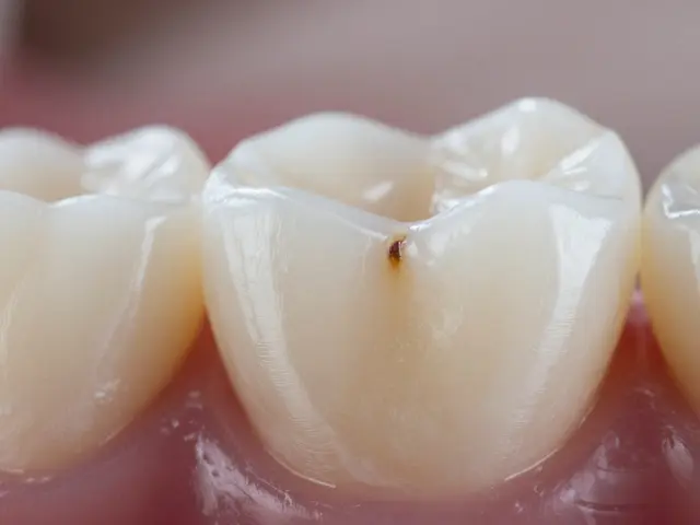 Jak se lečí zakus? Komplexní průvodce léčbou a prevencí
