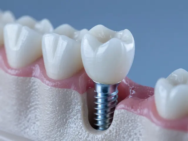 Kdy vyměnit zubní implantát? Životnost, rizika a role kompozitního inlayu