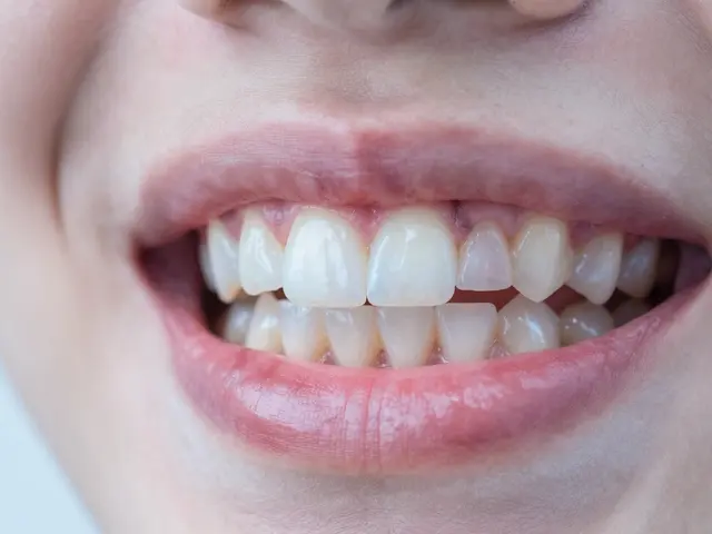 Jak si vytrhnout zub bez bolesti? Řešení mezizubního kazu a domácí péče